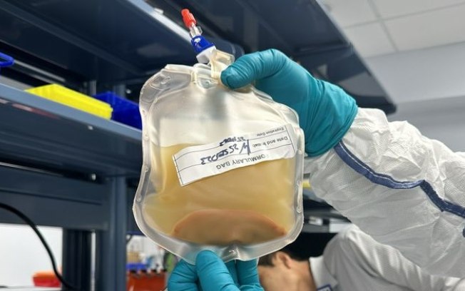 Terapia experimental cria um novo fígado em humanos, sem transplante