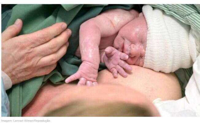 A mulher sueca teve parto tranquilo e bebê nasceu saudável. Médicos comemoram o sucesso do procedimento