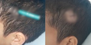 Aluno crava lápis na cabeça de colega em escola em SP