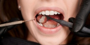 Síndrome do envelhecimento precoce bucal  desgasta os dentes