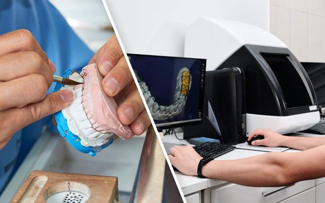 Brasil registra 25 mil técnicos em prótese dentária digital