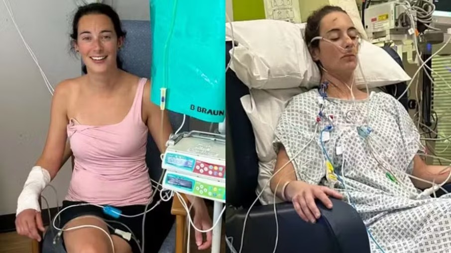 Câncer raro faz mulher passar por cirurgia em 13 órgãos Câncer raro faz mulher passar por cirurgia em 13 órgãos