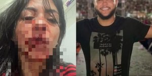 Após ter dentes quebrados, mulher retira a queixa contra cantor