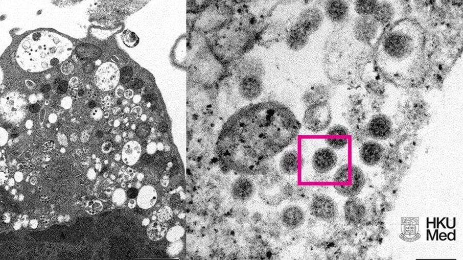 Cientistas de Hong Kong revelam imagem de microscópio da variante Ômicron