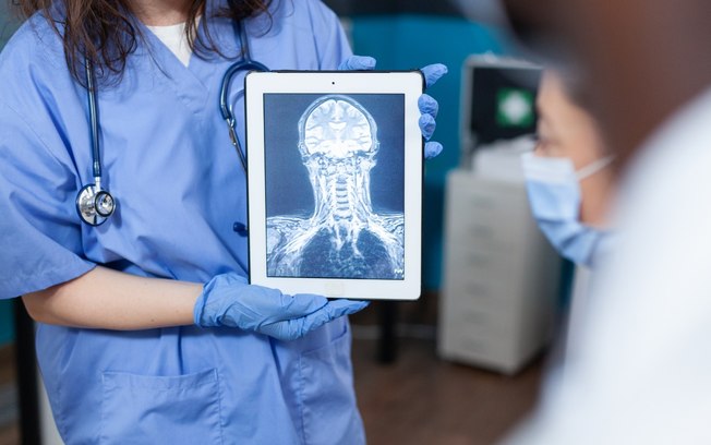 Inteligência artificial auxilia no diagnóstico por imagem