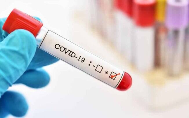 Desde o início da pandemia, mais de 31 milhões pessoas foram infectadas em todo o mundo Desde o início da pandemia, mais de 31 milhões pessoas foram infectadas em todo o mundo