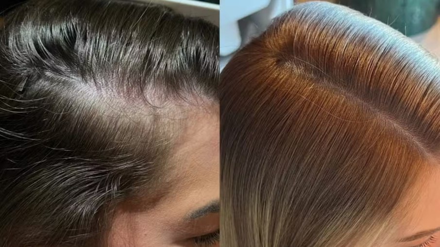 Antes e depois de Lore Improta Antes e depois de Lore Improta