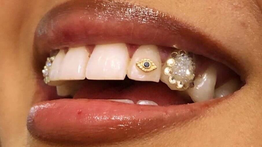 As joias nos dentes são as queridinhas das celebridades