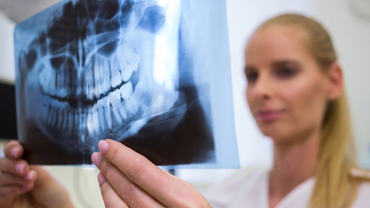 HPV%20na%20boca%3A%20um%20alerta%20silencioso