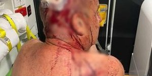 Homem tenta salvar cachorro e é espancado por canguru