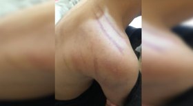 Mulher morre após cair de paredão durante rapel em MG