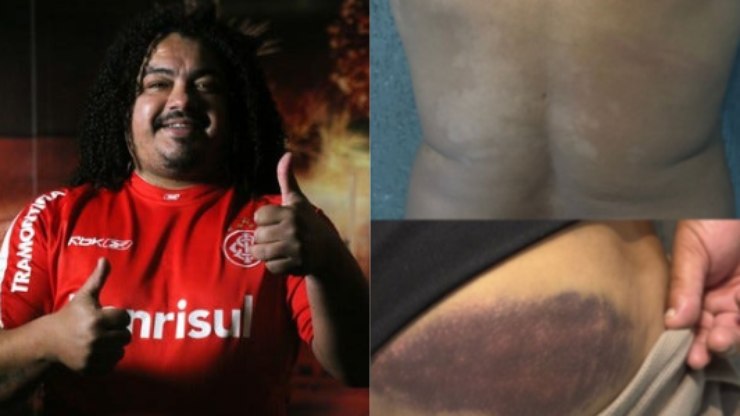 Ex-Inter e Corinthians é agredido por PM após jogo no Paraná