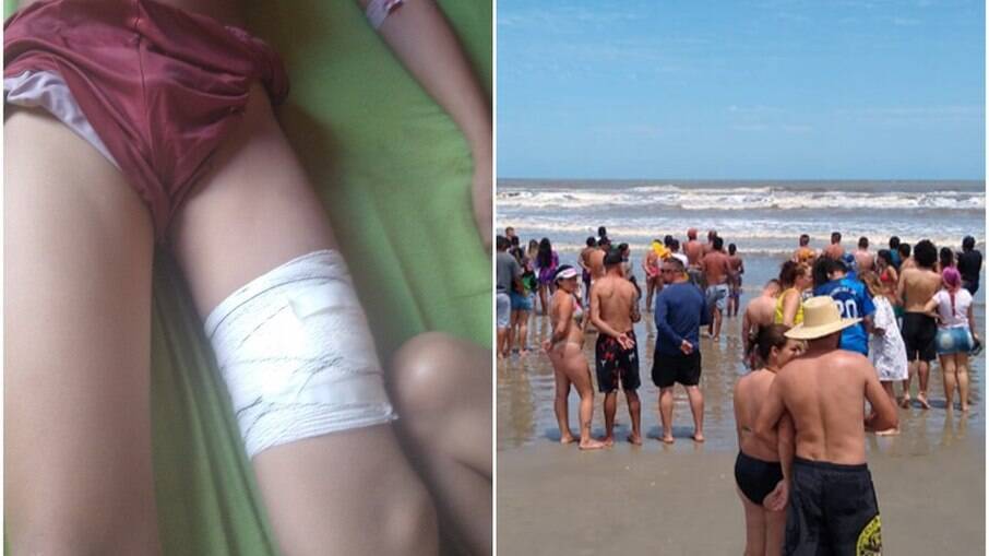 Menino foi atacado por tubarão em praia de São Paulo