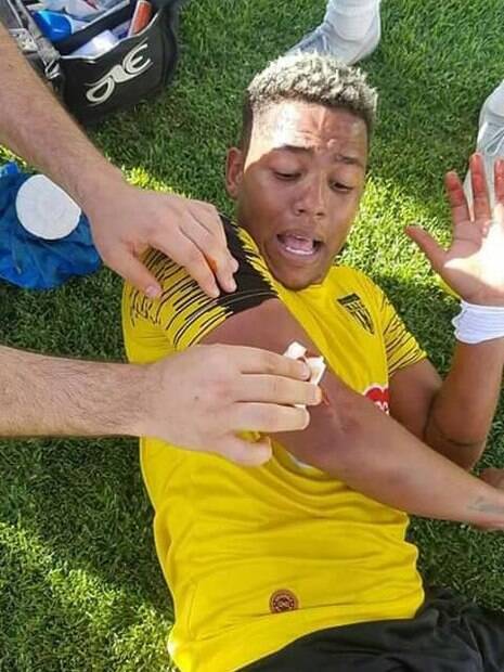 Gil Bahia%2C jogador brasileiro%2C levou uma pedrada durante partida na Tunísia Gil Bahia, jogador brasileiro, levou uma pedrada durante partida na Tunísia