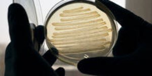 Surto de E. coli ligado a queijo cheddar cru atinge 7 pessoas