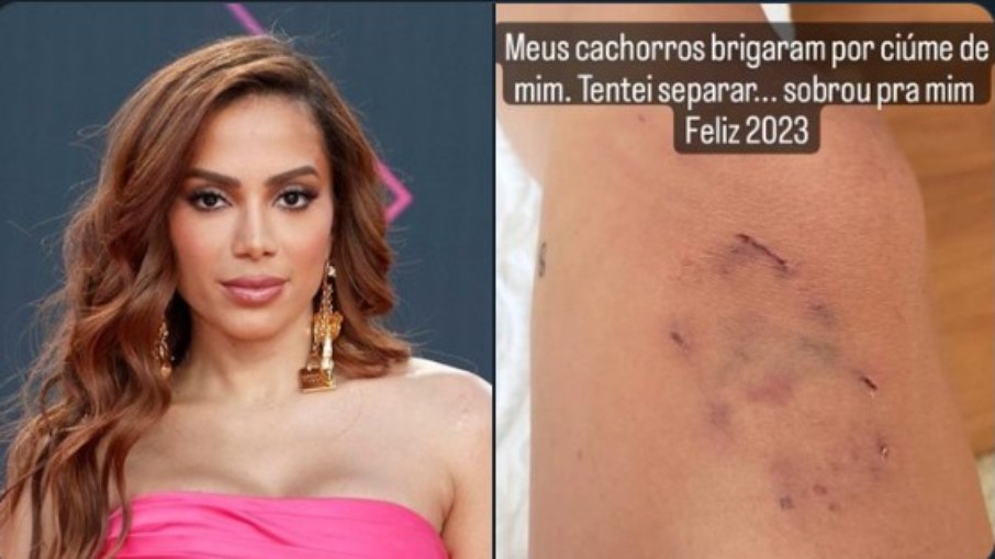 Anitta recebe mordida de cachorro