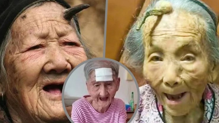 Idosa de 98 anos corta 