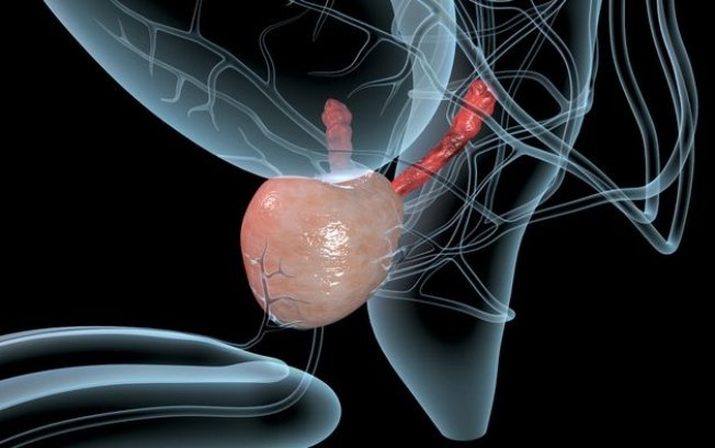 Casos de câncer de próstata devem dobrar até 2040