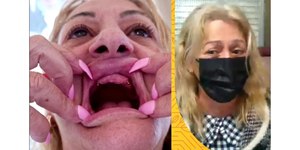Mulher viaja para cirurgia nos seios e fica sem os dentes