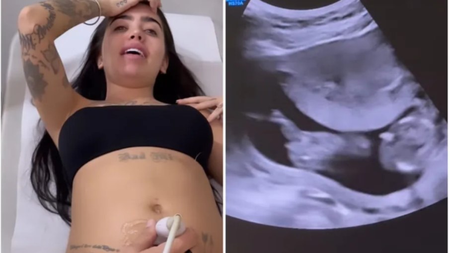 Grávida, MC Mirella mostra ultrassom e se surpreende com bebê