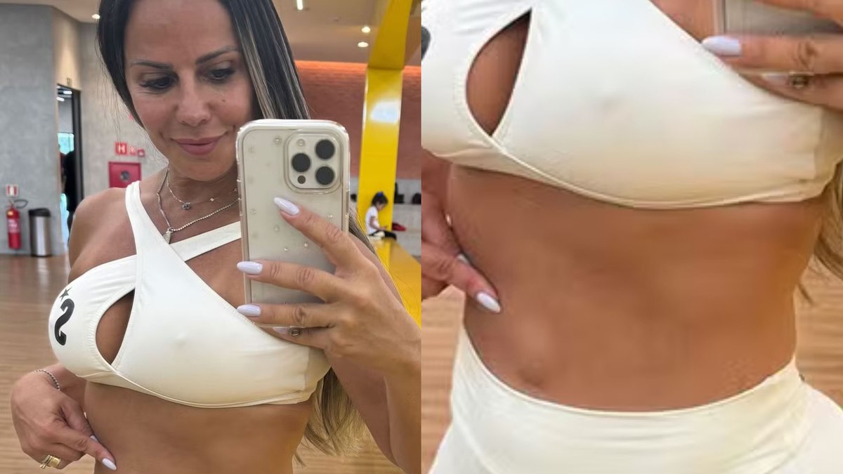 Viviane Araujo mostra hérnia umbilical