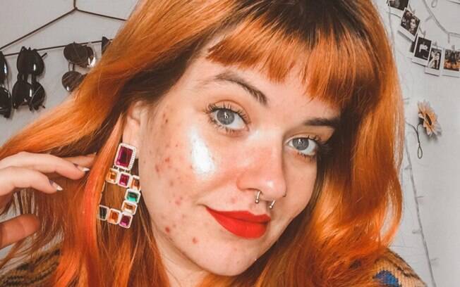 Júlia achou nas redes sociais um lugar para falar de autoaceitação e de acne