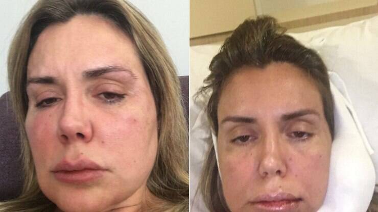 Renata Banhara mostra antes e depois de recuperação ...