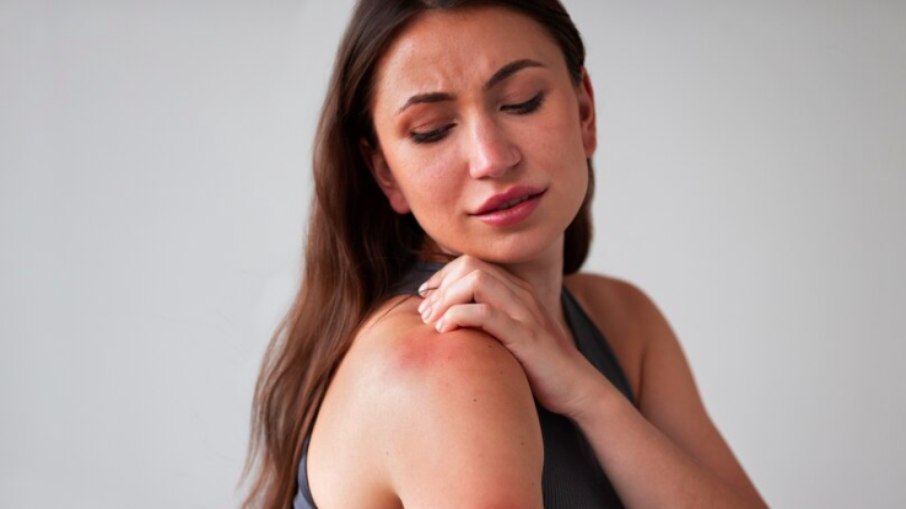 Alergias de pele: conheça as mais comuns no verão e proteja-se! 
