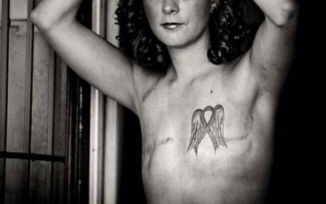 Tatuagens podem ser opção para mulheres que reconstituíram as mamas ou não