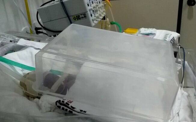 Bebê prematuro é mantido em incubadora improvisada em hospital do Amapá