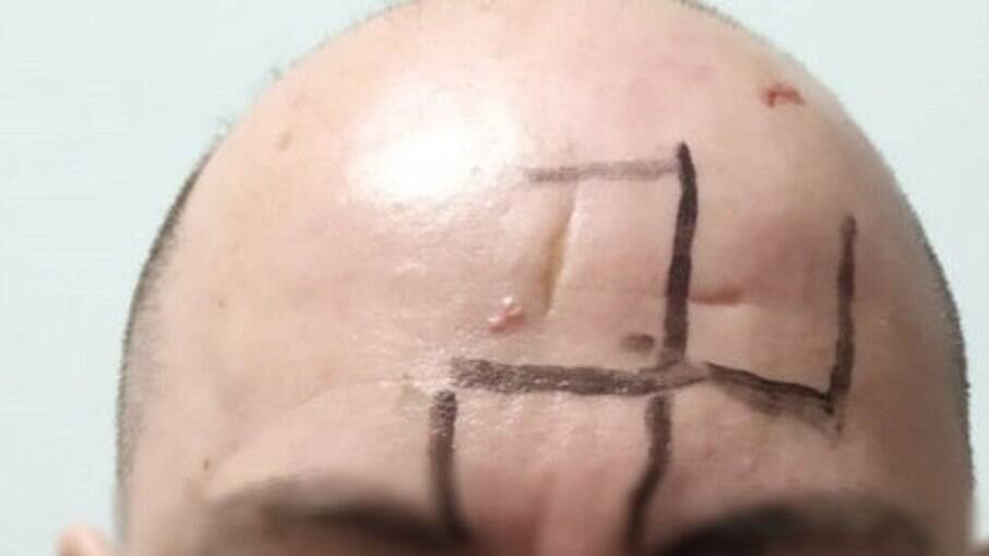 Vítima teve suástica, símbolo do regime nazista, desenhada na testa