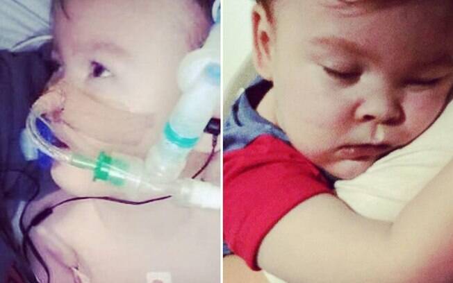 Alfie Evans não resistiu à doença rara depois de os aparelhos que o mantinham respirando foram desligados Alfie Evans não resistiu à doença rara depois de os aparelhos que o mantinham respirando foram desligados