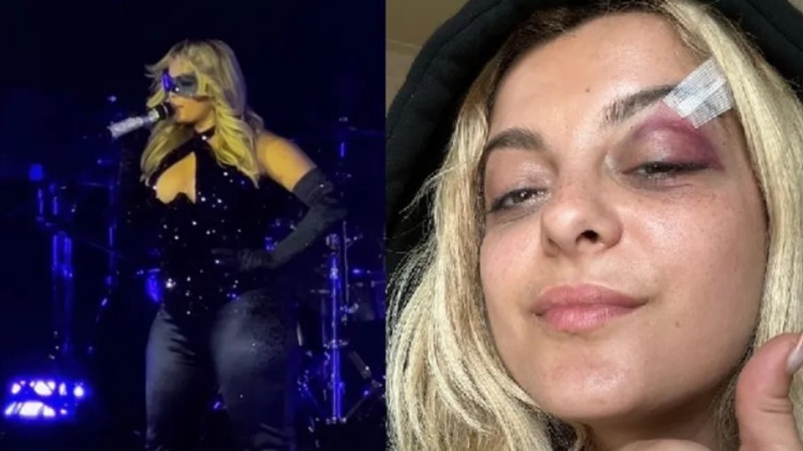 Bebe Rexha usa óculos de proteção em show após ataque de fã