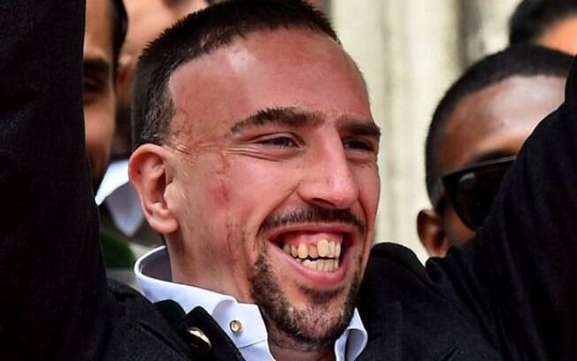 Jogadores feios da história do futebol - Franck Ribéry