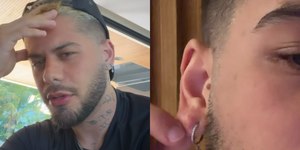 Zé Felipe sofre acidente e passa por cirurgia