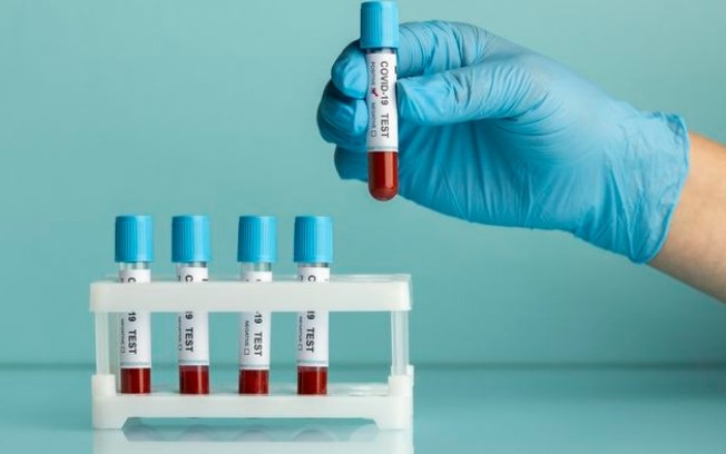 Exame de sangue simples pode revolucionar diagnóstico de Alzheimer