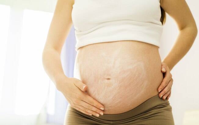 A incontinência urinária que afeta mulheres após os 40 anos pode estar associadas às estrids da gravidez
