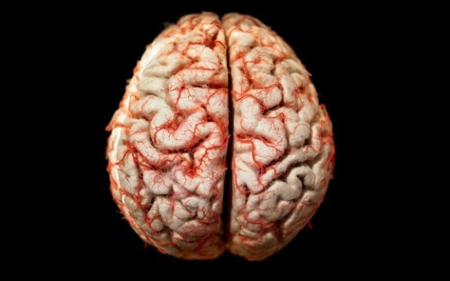Organoides ajudam a entender desenvolvimento do cérebro humano
