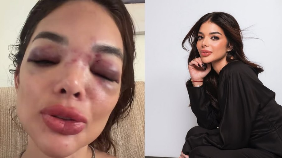 Cirurgiã-dentista Giullia Falcão denuncia marido por violência doméstica Cirurgiã-dentista Giullia Falcão denuncia marido por violência doméstica