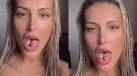 Sonia Abrão detona Andressa Urach depois de cirurgia na língua