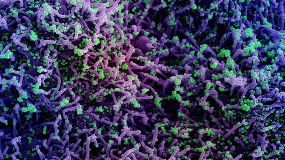 Micrografia eletrônica de varredura de uma célula infectada com uma cepa variante das partículas do vírus SARS-CoV-2