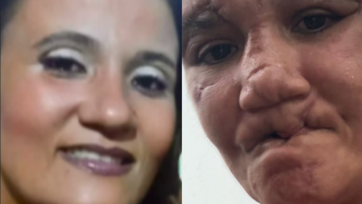 Mulher sobrevive a década de tortura e quer reconstruir vida Mulher sobrevive a década de tortura e quer reconstruir vida