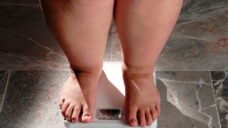 Obesidade: quando é hora de ir além do tratamento clínico e considerar a cirurgia?