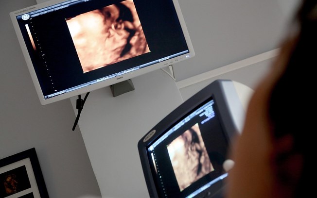 Pesquisa reforça técnica fetal para hérnia diafragmática