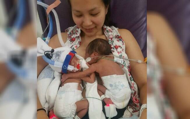 As irmãs gêmeas Olivia e Zoe nasceram prematuras e só se conheceram 27 dias após virem ao mundo