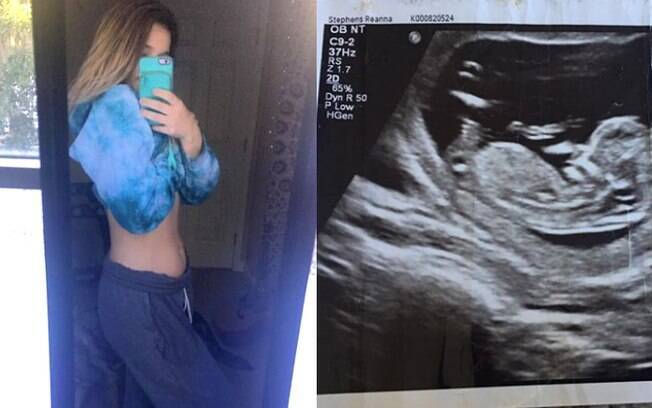 Jovem Reanna Stephens compartilhou fotos da sua barriga de grávida no Instagram, mas nem todos acreditam na história