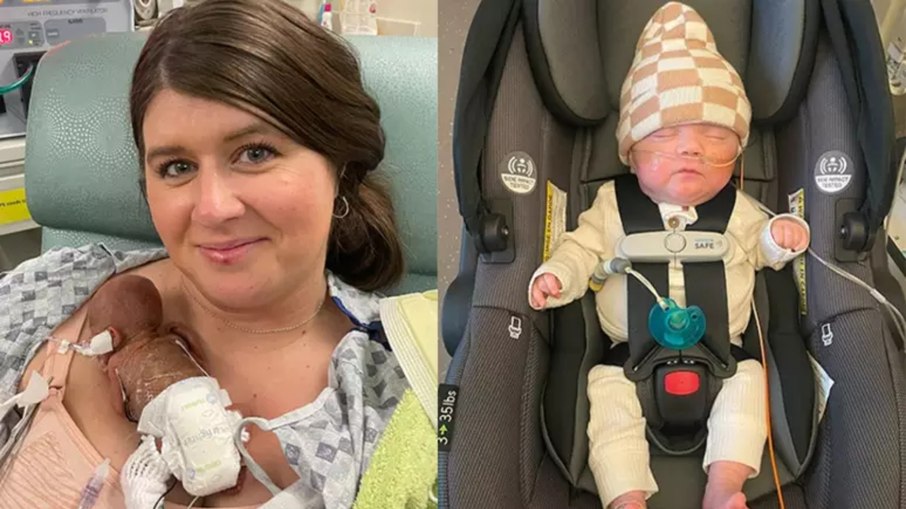 Nascido com 280g, bebê mais prematuro do mundo celebra 1 ano