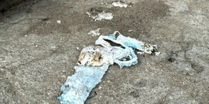RJ: bebê morre com 90% do corpo queimado após explosão com álcool