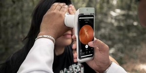 SUS de Campinas passa a contar com exame de retina com IA