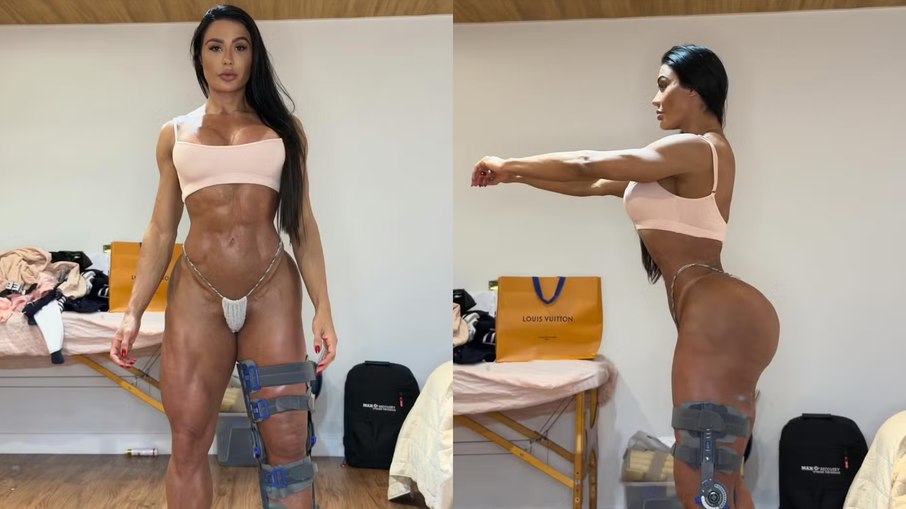 Gracyanne Barbosa mostra corpo após lesão Gracyanne Barbosa mostra corpo após lesão